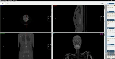 DCTViewer 開啟醫(yī)學(xué)三維分析新視界